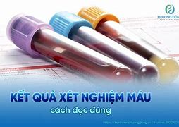 Hướng Dẫn Đọc Kết Quả Xét Nghiệm Máu